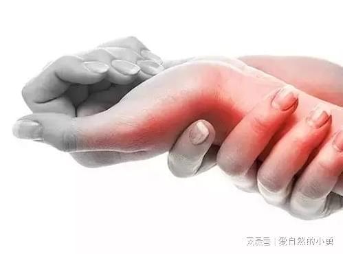 轻松搞定！经验分享！球王会多年腱鞘炎一招